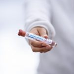 東京の抗体検査の抗体保有率0.1％は低過ぎ